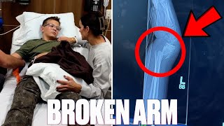 NOT WHAT WE MEANT BY FALL BREAK  BROKEN ARM  BOTH BONES BROKEN AT WRIST  BROKEN BONE ACCIDENT [upl. by Mita]