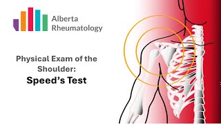 Speeds Test Rheumatology Shoulder Physical Exam Special Tests [upl. by Maitilde]