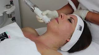 RENOVA  Nonsurgical Face Lift and Body Sculpting [upl. by Hainahpez772]