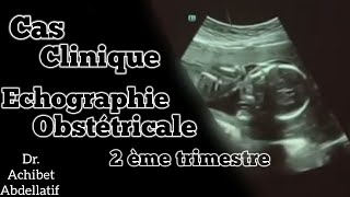 Formation  Échographie Obstétricale 2 ème trimestre Dr Achibet Abdellatif [upl. by Cody]