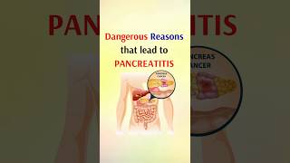 Dangerous reasons that lead to pancreatitis shorts [upl. by Roxi382]