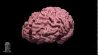 Alzheimers disease brain morph [upl. by Chassin705]