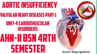 Aortic InsufficiencyDisease No4 Valvular Heart Diseases part1 Unit5 Cardiovascular Disorders AHN [upl. by Nej691]