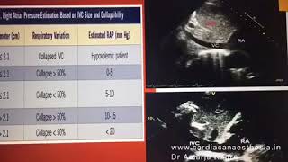 Transthoracic Echocardiography [upl. by Hyps565]