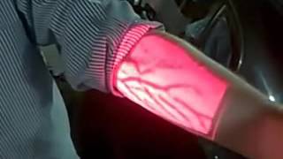 Vein Finder Demonstration [upl. by Eentrok521]