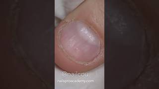 35 years Growth of Short Bitten Nails ✌️ [upl. by Eislek]