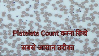 Platelet count under microscope  Platelets Count करना सिखे [upl. by Francine]