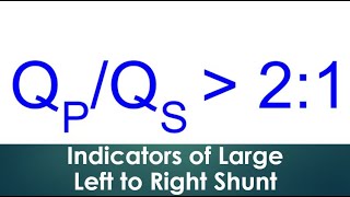 Indicators of Large Left to Right Shunt [upl. by Atsedom]