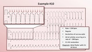 Intro to EKG Interpretation  Practicing Tachyarrhythmia Identification [upl. by Madelina958]