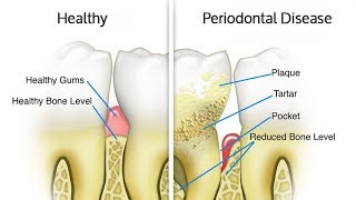 Introduction to Periodontology  Periodontics [upl. by Haerr]