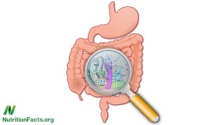 Bowel Wars Hydrogen Sulfide vs Butyrate [upl. by Swiercz]