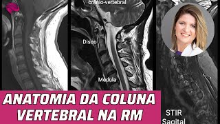 ANATOMIA DA COLUNA VERTEBRAL NA RESSONÂNCIA MAGNÉTICA [upl. by Atteynot]