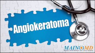 Angiokeratoma ¦ Treatment and Symptoms [upl. by Ahsieket]