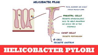 Helicobacter Pylori [upl. by Leruj]