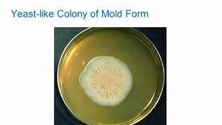 Dimorphic Fungi Sporothrichosis Hot Topic [upl. by Ynaoj776]