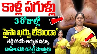 కాళ్ళ పగుళ్ళు చిటికెలో తగ్గాలంటే  Kaalla pagullu  How to Get Rid  Dr Shaguftha  iDream Health [upl. by Lorenzana]