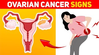 9 Warning Signs of Ovarian Cancer Every Woman Should Know [upl. by Spoor]