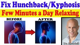 Fix HunchbackKyphosis in Just a Few Minutes a Day While Relaxing  Dr Alan Mandell DC [upl. by Yniffit]