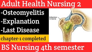 osteomyelitis causes symptoms diagnosis treatment amp pathology in Urdu and Hindi Disorderlast [upl. by Delwin36]