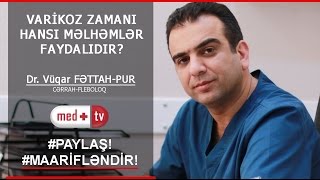 VARIKOZ ZAMANI HANSI MELHEMLER FAYDALIDIR  Dr Fettah  Pur Vuqar Cerrah Fleboloq [upl. by Scriven]