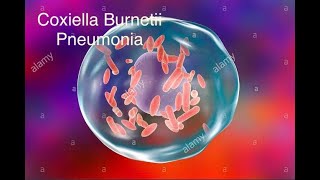 Coxiella burnetii pneumonia [upl. by Ybok585]