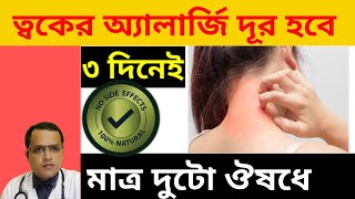 Allergies  Skin allergy  skin allergy medicine bengali  Doctors Advices allergytreatment [upl. by Massarelli]