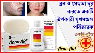 AcneAid Medicated Bar । ব্রন ও মেছতা দূর করতে । ব্রন ও মেছতার সেরা সাবান । Acne Aid Bar Review [upl. by Seana772]