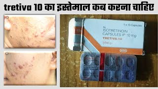 Tretiva 10 mg Capsule Uses  Isotretinoin Uses side Effects amp Dose In Hindi tretiva 10 mg benefits [upl. by Arly829]