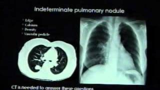 Chestx  ray reading Dr  Mamdouh Mahfouz [upl. by Idelle]