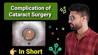 Complication of cataract surgery lecture opthalmology [upl. by Risley]