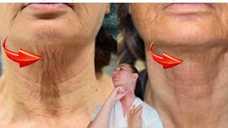 Big massage tutorial for the Neck and DECOLLETTE AREA  Turkey neck  Sagging neck [upl. by Kristy]