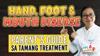 HAND FOOT and MOUTH DISEASE  Parents Guide sa Tamang Gamutan  Doc A Pediatrician [upl. by Hayyim]