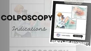 What is colposcopy  The diagnostic procedure Colposcope  Indication of colposcopy [upl. by Ellis]