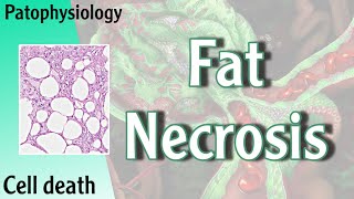 Pathophysiology  Fat Necrosis Hani Laith شرح [upl. by Esertal]