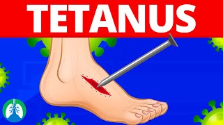 Tetanus Medical Definition  Quick Explainer Video [upl. by Rrats]