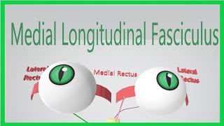 Medial Longitudinal Fasciculus Made Ridiculously Simple [upl. by Andriette785]