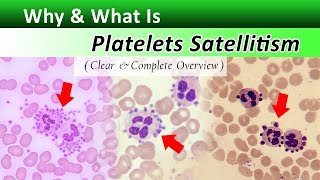 What is Platelets Satellitism   Increase Your Identification Skills [upl. by Adranoel]