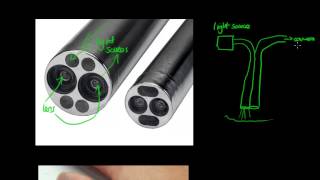 How Does an Endoscope Work  GCSE Physics [upl. by Carpio]