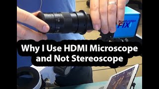 Why I prefer HDMI Microscope and not Binocular Stereoscope What is a Barlow lens and comparison [upl. by Arte454]