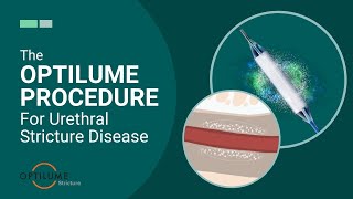 The Optilume Procedure For Urethral Stricture Disease [upl. by Elenaj]