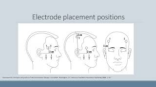 Expert Talks  Bifrontal ECT In Schizophrenia Current Evidence Review [upl. by Etnad]