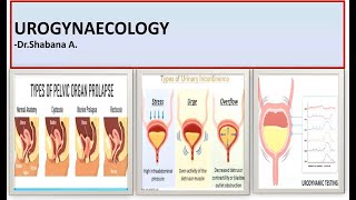 UROGYNAECOLOGY SESSION  CystocelePOPduring pregnancy amp UrodynamicsGraph Interpretation made easy [upl. by Solberg]