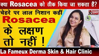 चेहरे पर Rosacea यानी लाल चकत्तों से बचना है  Dermatologist से जानिए क्या करें  La Fameux Derma [upl. by Aisetra]