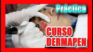 🔴 DERMAPEN  CURSO GRATIS 2021🏆  Demostración paso a paso Dr Sergio Zerpa MICRONEEDLING TUTORIAL [upl. by Aihseuqal]