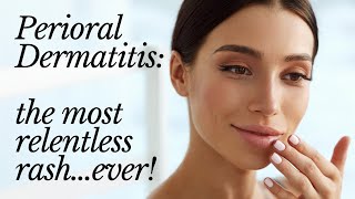 PERIORAL DERMATITIS the most relentless rashever [upl. by Epuladaug]