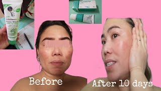 Pigmanorm and Facial Wash Review  Pangtanggal NG Pikas o Melasma  Ate Marian [upl. by Selij]