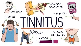 Understanding the Causes of Tinnitus [upl. by Greggory]