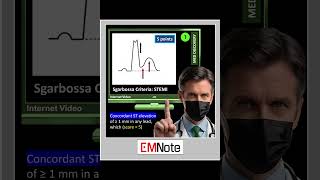 Sgarbossa Criteria of STEMI [upl. by Kazim289]