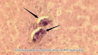 Schistosoma japonicum Egg in Tissue with Haematoxylin and Eosin HampE Stain [upl. by Merceer480]