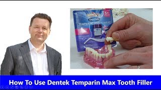 ✅ How To Use Dentek Temparin Max Tooth Filling and Crown Repair Review [upl. by Eidnahs]